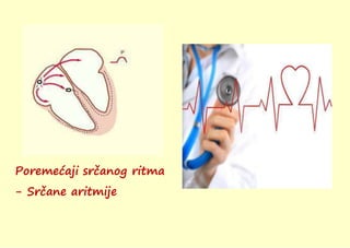 Poremećaji srčanog ritma
- Srčane aritmije
 