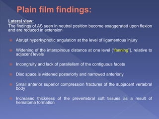 Lateral view:
The findings of AS seen in neutral position become exaggerated upon flexion
and are reduced in extension
 Abrupt hyperkyphotic angulation at the level of ligamentous injury
 Widening of the interspinous distance at one level (“fanning”), relative to
adjacent levels
 Incongruity and lack of parallelism of the contiguous facets
 Disc space is widened posteriorly and narrowed anteriorly
 Small anterior superior compression fractures of the subjacent vertebral
body
 Increased thickness of the prevertebral soft tissues as a result of
hematoma formation
 