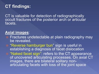 CT findings:
CT is valuable for detection of radiographically
occult fractures of the posterior arch or articular
facets.
Axial images:
 Fractures undetectable at plain radiography may
be revealed.
 “Reverse hamburger bun” sign is useful in
establishing a diagnosis of facet dislocation
 “Naked facet sign”: refers to the CT appearance
of uncovered articulating processes. On axial CT
images, there are bilateral solitary non-
articulating facets with loss of the joint space
 