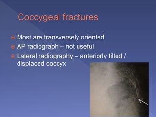  Most are transversely oriented
 AP radiograph – not useful
 Lateral radiography – anteriorly tilted /
displaced coccyx
 
