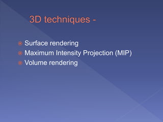  Surface rendering
 Maximum Intensity Projection (MIP)
 Volume rendering
 