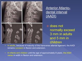 Anterior Atlanto-
dental interval
(AADI)
 does not
normally exceed
3 mm in adults
and 5 mm in
children
• In adults, because of maturity of the transverse atlantal ligament, the AADI
remains constant in flexion and extension.
• In infants and children until the age of approximately 8 years, the AADI
varies in width in flexion and extension.
 