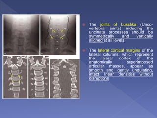 The joints of Luschka (Unco-
vertebral joints) including the
uncinate processes should be
symmetrically and vertically
aligned at all levels.
 The lateral cortical margins of the
lateral columns, which represent
the lateral cortex of the
anatomically superimposed
articular masses, appear as
smooth and gently undulating,
intact linear densities without
disruptions
 