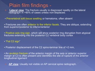  Lateral view: The fracture usually is diagnosed readily on the lateral
radiograph in >90% of cases unless non-displaced.
▪ Prevertebral soft tissue swelling or hematoma, often absent
▪ Fractures are often anterior to the inferior facets. They are oblique, extending
from superior/posterior to inferior/anterior
▪ Positive axis ring sign, which will show posterior ring disruption from atypical
fractures extending into the posterior C2 vertebral body cortex
▪ “Fat C2 sign”
▪ Posterior displacement of the C2 spino-laminar line of >2 mm,
▪ An avulsion fracture of the anterior margin of the axis or anterior superior
margin at C3 is often present and identifies the site of rupture of the anterior
longitudinal ligament
 AP view: Usually not visible on AP cervical spine radiograph.
 