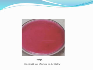 200µl
No growth was observed on the plate e
 