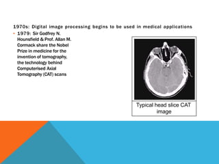 1970s: Digital image processing begins to be used in medical applications
▪ 1979: Sir Godfrey N.
Hounsfield & Prof. Allan M.
Cormack share the Nobel
Prize in medicine for the
invention of tomography,
the technology behind
Computerised Axial
Tomography (CAT) scans
Typical head slice CAT
image
 