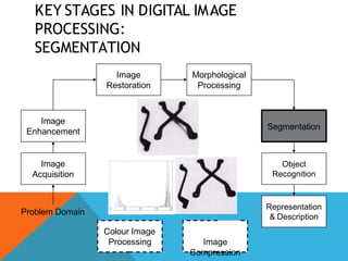 KEY STAGES IN DIGITAL IMAGE
PROCESSING:
SEGMENTATION
Image
Acquisition
Image
Restoration
Morphological
Processing
Segmentation
Representation
& Description
Image
Enhancement
Object
Recognition
Problem Domain
Colour Image
Processing Image
Compression
 