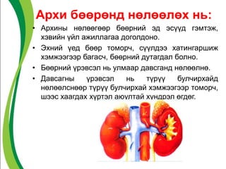 Архи бөөрөнд нөлөөлөх нь:
• Архины нөлөөгөөр бөөрний эд эсүүд гэмтэж,
хэвийн үйл ажиллагаа доголдоно.
• Эхний үед бөөр томорч, сүүлдээ хатингаршиж
хэмжээгээр багасч, бөөрний дутагдал болно.
• Бөөрний үрэвсэл нь улмаар давсганд нөлөөлнө.
• Давсагны үрэвсэл нь түрүү булчирхайд
нөлөөлснөөр түрүү булчирхай хэмжээгээр томорч,
шээс хаагдах хүртэл аюултай хүндрэл өгдөг.
 