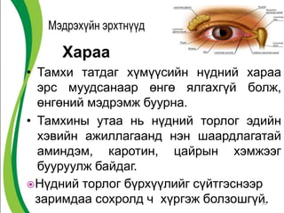 Хараа
• Тамхи татдаг хүмүүсийн нүдний хараа
эрс муудсанаар өнгө ялгахгүй болж,
өнгөний мэдрэмж буурна.
• Тамхины утаа нь нүдний торлог эдийн
хэвийн ажиллагаанд нэн шаардлагатай
аминдэм, каротин, цайрын хэмжээг
бууруулж байдаг.
Нүдний торлог бүрхүүлийг сүйтгэснээр
заримдаа сохролд ч хүргэж болзошгүй.35
 
