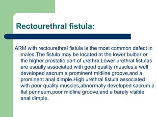 Rectourethral fistula:
ARM with rectourethral fistula is the most common defect in
males.The fistula may be located at the lower bulbar or
the higher prostatic part of urethra.Lower urethral fistulas
are usually associated with good quality muscles,a well
developed sacrum,a prominent midline groove,and a
prominent anal dimple.High urethral fistula associated
with poor quality muscles,abnormally developed sacrum,a
flat perineum,poor midline groove,and a barely visible
anal dimple.
 