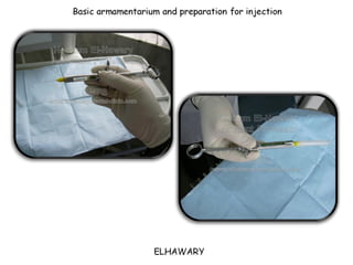 Armamentarium utilized for dental anesthesia