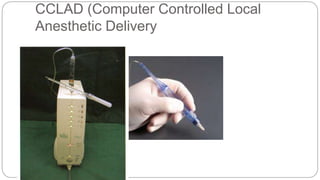 CCLAD (Computer Controlled Local
Anesthetic Delivery
 