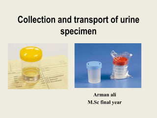 Collection and transport of urine
specimen
Arman ali
M.Sc final year
 
