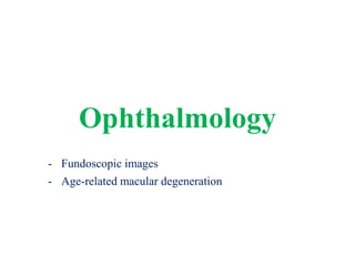 Ophthalmology
- Fundoscopic images
- Age-related macular degeneration
 