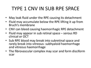 Fluid Under Rpe armd.pptx