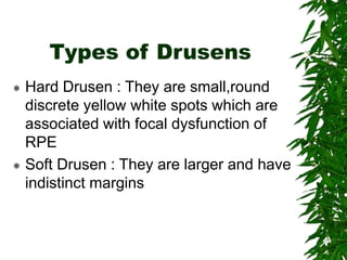 Types of Drusens
 Hard Drusen : They are small,round
discrete yellow white spots which are
associated with focal dysfunction of
RPE
 Soft Drusen : They are larger and have
indistinct margins
 