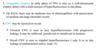 Window Defect Ffa Hyper ARMD(age related macular degeneration).pptx