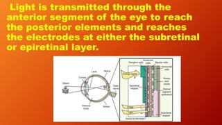 Light is transmitted through the
anterior segment of the eye to reach
the posterior elements and reaches
the electrodes at either the subretinal
or epiretinal layer.
 