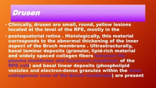 Drusen
• Clinically, drusen are small, round, yellow lesions
located at the level of the RPE, mostly in the
• postequatorial retina . Histologically, this material
corresponds to the abnormal thickening of the inner
aspect of the Bruch membrane . Ultrastructurally,
basal laminar deposits (granular, lipid-rich material
and widely spaced collagen fibers between the
plasma membrane and basement membrane of the
RPE cell) and basal linear deposits (phospholipid
vesicles and electron-dense granules within the inner
collagenous zone of the Bruch membrane) are present
 