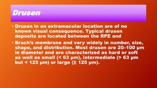 Drusen
• Drusen in an extramacular location are of no
known visual consequence. Typical drusen
deposits are located between the RPE and
• Bruch’s membrane and vary widely in number, size,
shape, and distribution. Most drusen are 20–100 μm
in diameter and are characterized as hard or soft
as well as small (< 63 μm), intermediate (> 63 μm
but < 125 μm) or large (≥ 125 μm).
 
