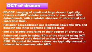 OCT of drusen
• SD-OCT imaging of small and large drusen typically
reveals sub-RPE nodular elevations or even small RPE
detachments with a notable absence of intraretinal and
subretinal fluid .
• Reticular pseudodrusen are identified above the RPE and
beneath the inner segment ellipsoid layer
• and are graded according to their degree of elevation .
• Enhanced depth imaging (EDI) of the choroid using OCT
has permitted more detailed analysis of the choroid in
AMD. Choroidal thickness values are typically normal or
reduced in nonneovascular AMD.
 