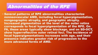 Abnormalities of the RPE
• Several patterns of RPE abnormalities characterize
nonneovascular AMD, including focal hyperpigmentation,
nongeographic atrophy, and geographic atrophy.
Increased pigmentation at the level of the outer retina
corresponds to focal hyperpigmentation of the RPE. On
FA, these areas typically show blockage, and on SD-OCT,
show hyperreflective outer retinal foci. The incidence of
focal hyperpigmentations increases with age, and their
presence indicates greater risk of progression to the
more advanced forms of AMD.
 