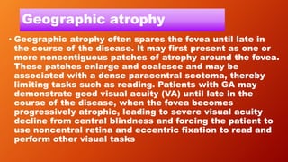 Geographic atrophy
• Geographic atrophy often spares the fovea until late in
the course of the disease. It may first present as one or
more noncontiguous patches of atrophy around the fovea.
These patches enlarge and coalesce and may be
associated with a dense paracentral scotoma, thereby
limiting tasks such as reading. Patients with GA may
demonstrate good visual acuity (VA) until late in the
course of the disease, when the fovea becomes
progressively atrophic, leading to severe visual acuity
decline from central blindness and forcing the patient to
use noncentral retina and eccentric fixation to read and
perform other visual tasks
 