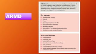 ARMD
 