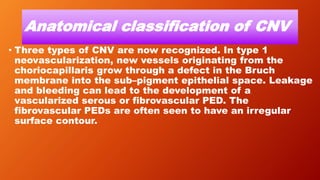 Anatomical classification of CNV
• Three types of CNV are now recognized. In type 1
neovascularization, new vessels originating from the
choriocapillaris grow through a defect in the Bruch
membrane into the sub–pigment epithelial space. Leakage
and bleeding can lead to the development of a
vascularized serous or fibrovascular PED. The
fibrovascular PEDs are often seen to have an irregular
surface contour.
 