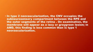 • In type 2 neovascularization, the CNV occupies the
subneurosensory compartment between the RPE and
the outer segments of the retina . On examination, the
membrane will appear as a lacy or graygreen lesion; in
AMD, this finding is less common than is type 1
neovascularization.
 