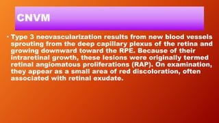 CNVM
• Type 3 neovascularization results from new blood vessels
sprouting from the deep capillary plexus of the retina and
growing downward toward the RPE. Because of their
intraretinal growth, these lesions were originally termed
retinal angiomatous proliferations (RAP). On examination,
they appear as a small area of red discoloration, often
associated with retinal exudate.
 