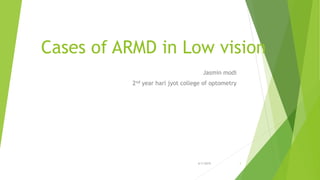 Cases of ARMD in Low vision
Jasmin modi
2nd year hari jyot college of optometry
6/1/2019 1
 