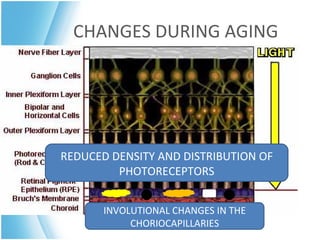 CHANGES DURING AGING




REDUCED DENSITY AND DISTRIBUTION OF
         PHOTORECEPTORS


       INVOLUTIONAL CHANGES IN THE
            CHORIOCAPILLARIES
 