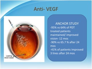 Anti- VEGF
     • MARINA Study
            ANCHOR STUDY
     • 95% of Ranibizumab
       -95% vs 64% of PDT
        treated patients
       treated patients
        experienced visual
       maintained/ improved
       vision- 12 mos vs 62% of
        improvement
       -90% vstreated patients
        sham 65.7 % after 24
      mos
      -41% of patients improved
      3 lines after 24 mos
 