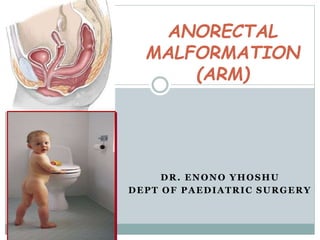 DR. ENONO YHOSHU
DEPT OF PAEDIATRIC SURGERY
ANORECTAL
MALFORMATION
(ARM)
 