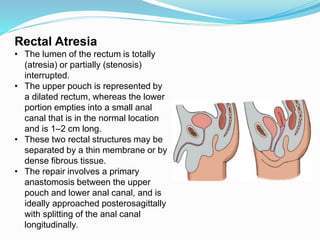 Rectal Atresia
• The lumen of the rectum is totally
(atresia) or partially (stenosis)
interrupted.
• The upper pouch is represented by
a dilated rectum, whereas the lower
portion empties into a small anal
canal that is in the normal location
and is 1–2 cm long.
• These two rectal structures may be
separated by a thin membrane or by
dense fibrous tissue.
• The repair involves a primary
anastomosis between the upper
pouch and lower anal canal, and is
ideally approached posterosagittally
with splitting of the anal canal
longitudinally.
 