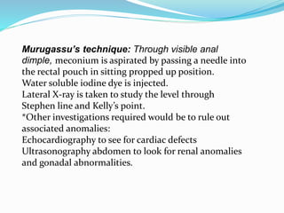 Murugassu’s technique: Through visible anal
dimple, meconium is aspirated by passing a needle into
the rectal pouch in sitting propped up position.
Water soluble iodine dye is injected.
Lateral X-ray is taken to study the level through
Stephen line and Kelly’s point.
*Other investigations required would be to rule out
associated anomalies:
Echocardiography to see for cardiac defects
Ultrasonography abdomen to look for renal anomalies
and gonadal abnormalities.
 
