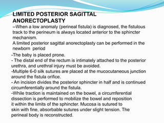 LIMITED POSTERIOR SAGITTAL
ANORECTOPLASTY
--When a low anomaly (perineal fistula) is diagnosed, the fistulous
track to the perineum is always located anterior to the sphincter
mechanism.
A limited posterior sagittal anorectoplasty can be performed in the
newborn period
-The baby is placed prone.
- The distal end of the rectum is intimately attached to the posterior
urethra, and urethral injury must be avoided.
-Multiple 6-0 silk sutures are placed at the mucocutaneous junction
around the fistula orifice.
- An incision divides the posterior sphincter in half and is continued
circumferentially around the fistula.
-While traction is maintained on the bowel, a circumferential
dissection is performed to mobilize the bowel and reposition
it within the limits of the sphincter. Mucosa is sutured to
skin with fine, absorbable sutures under slight tension. The
perineal body is reconstructed.
 