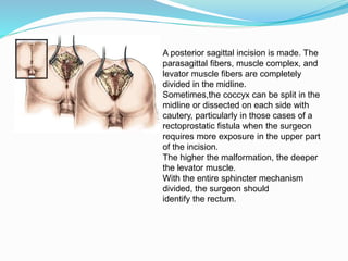 A posterior sagittal incision is made. The
parasagittal fibers, muscle complex, and
levator muscle fibers are completely
divided in the midline.
Sometimes,the coccyx can be split in the
midline or dissected on each side with
cautery, particularly in those cases of a
rectoprostatic fistula when the surgeon
requires more exposure in the upper part
of the incision.
The higher the malformation, the deeper
the levator muscle.
With the entire sphincter mechanism
divided, the surgeon should
identify the rectum.
 