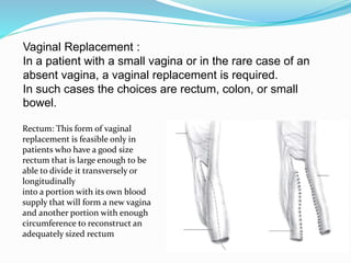 Vaginal Replacement :
In a patient with a small vagina or in the rare case of an
absent vagina, a vaginal replacement is required.
In such cases the choices are rectum, colon, or small
bowel.
Rectum: This form of vaginal
replacement is feasible only in
patients who have a good size
rectum that is large enough to be
able to divide it transversely or
longitudinally
into a portion with its own blood
supply that will form a new vagina
and another portion with enough
circumference to reconstruct an
adequately sized rectum
 