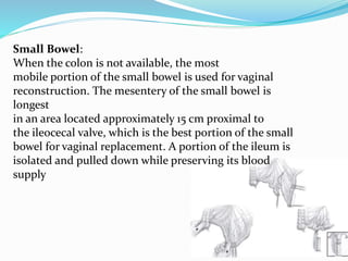 Small Bowel:
When the colon is not available, the most
mobile portion of the small bowel is used for vaginal
reconstruction. The mesentery of the small bowel is
longest
in an area located approximately 15 cm proximal to
the ileocecal valve, which is the best portion of the small
bowel for vaginal replacement. A portion of the ileum is
isolated and pulled down while preserving its blood
supply
 
