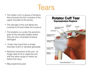 Tears
• The rotator cuff is a group of tendons
that connects the four muscles of the
upper shoulder to the bones.
• The strength of the cuff allows the
muscles to lift and rotate the humerus
• The tendons run under the acromion
(part of the shoulder blade) where
they are very vulnerable to being
damaged
• A tear may result from a single
traumatic event or develop gradually
• Restricts movement of the arm. no
longer able to lift or rotate the arm
with the same range of motion as
before the injury
• May experience pain
 
