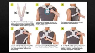 Arm slings & its types