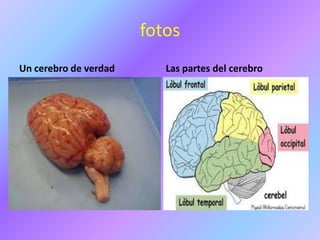 fotos
Un cerebro de verdad Las partes del cerebro
 