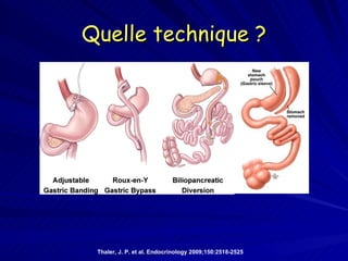 Quelle technique ? Thaler, J. P. et al. Endocrinology 2009;150:2518-2525 