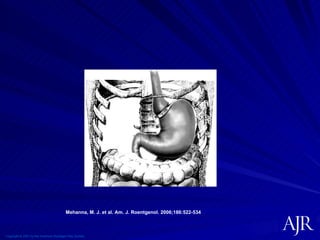 Copyright © 2007 by the American Roentgen Ray Society Mehanna, M. J. et al. Am. J. Roentgenol. 2006;186:522-534 