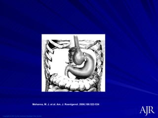 Copyright © 2007 by the American Roentgen Ray Society Mehanna, M. J. et al. Am. J. Roentgenol. 2006;186:522-534 