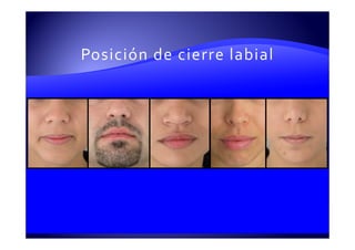 Posición de cierre labial
 