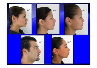 90° 120 ° 101 °
90 ° 84 °
 