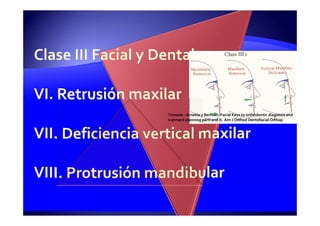 Tomado : Arnette y Berman: Facial Keys to orthodontic diagnosis and
tratment planning partI and II. Am J Orthod Dentofacial Orthop
 